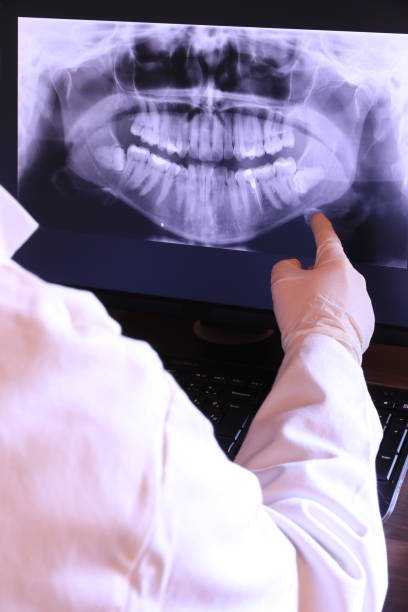 Best Emergency Tooth Extraction in Bryant, WA